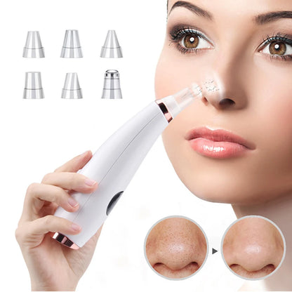 Electric Blackhead Remover Vacuum